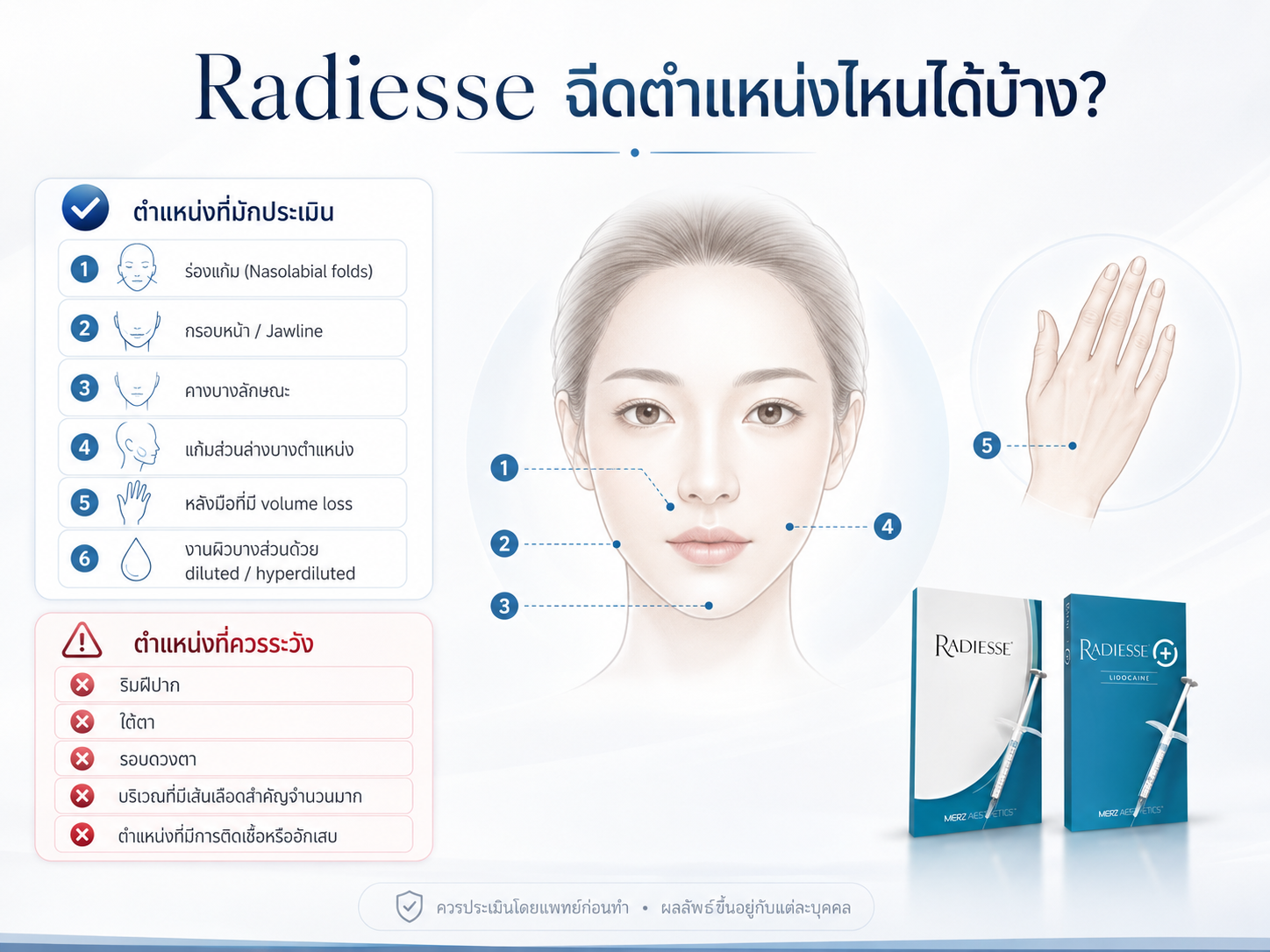 Radiesse 2